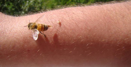 Veneno de abelha é a terceira causa mais frequente de alergia grave